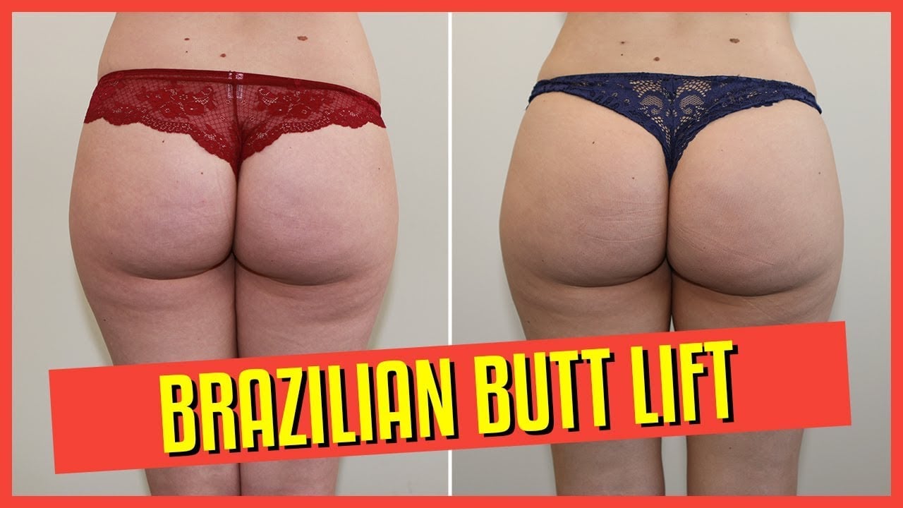 Brazilian Buttlift